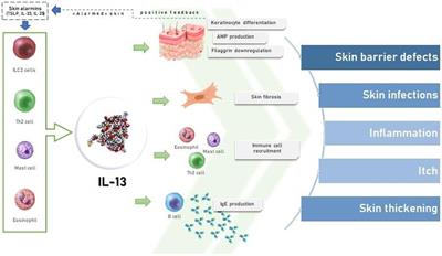 The hidden sentinel of the skin: An overview on the role of interleukin-13 in atopic dermatitis